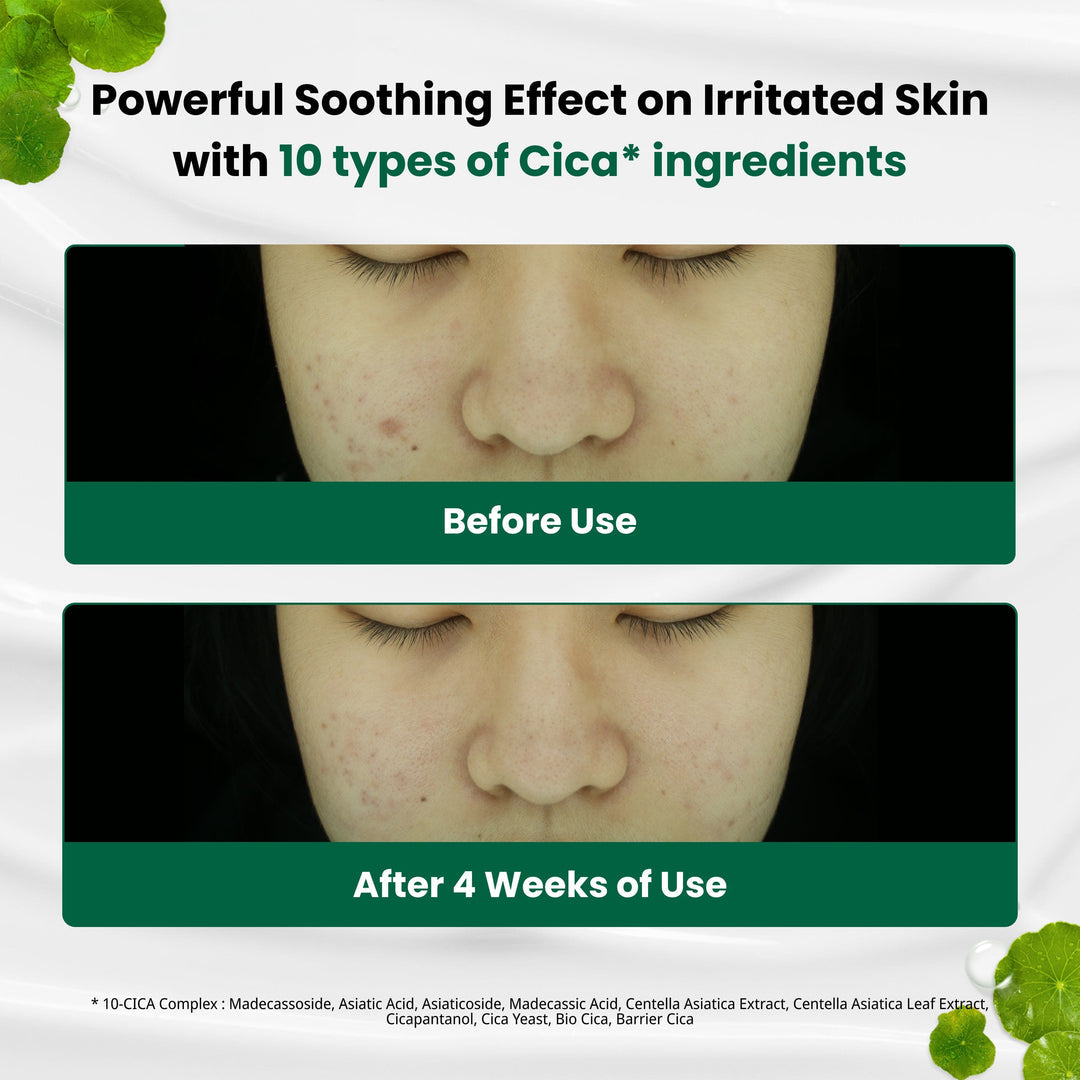 Dr.G Red Blemish Clear Soothing Cream.