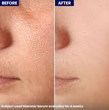 TIAM Pore Minimizing 21 Serum 40ml