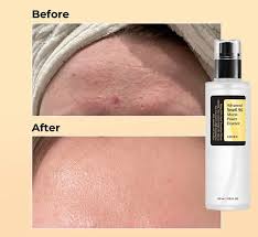 Cosrx Advanced Snail 96 Mucin Power Essence.